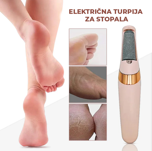 Električna turpija za pete – glatka stopala bez odlaska u salon